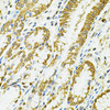 Immunology Antibodies 2 Anti-HLA-DQA1 Antibody CAB2168