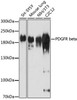 Cell Biology Antibodies 8 Anti-PDGFR beta Antibody CAB2180