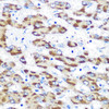 Cell Death Antibodies 1 Anti-PSEN1 Antibody CAB2187