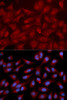 Cardiovascular Antibodies Anti-RAPGEF3 Antibody CAB2199