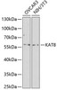 Epigenetics and Nuclear Signaling Antibodies 3 Anti-MYST1 Antibody CAB2208