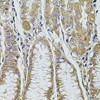 Cell Death Antibodies 1 Anti-ALIX / PDCD6IP Antibody CAB2215