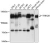 Immunology Antibodies 2 Anti-TRIM28 Antibody CAB2245