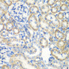 Epigenetics and Nuclear Signaling Antibodies 3 Anti-SMYD1 Antibody CAB2340