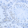 Epigenetics and Nuclear Signaling Antibodies 3 Anti-DiMethyl-Histone H3-K36 Antibody CAB2365