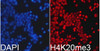 Cell Biology Antibodies 8 Anti-TriMethyl-Histone H4-K20 Antibody CAB2372