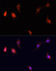 Cell Biology Antibodies 8 Anti-mTOR Antibody CAB2445