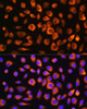 Immunology Antibodies 2 Anti-Hsc70 Antibody CAB2487