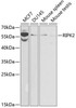 Immunology Antibodies 2 Anti-RIPK2 Antibody CAB2498