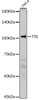 Cell Biology Antibodies 8 Anti-TTK Antibody CAB2500