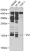 Cell Biology Antibodies 8 Anti-LYZ Antibody CAB2503
