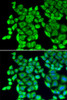 Metabolism Antibodies 2 Anti-EEF1D Antibody CAB2509