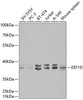 Metabolism Antibodies 2 Anti-EEF1D Antibody CAB2509