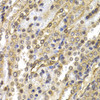 Cell Biology Antibodies 8 Anti-NEDD9 Antibody CAB2521