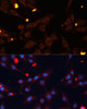 Cell Biology Antibodies 8 Anti-ADAMTS4 Antibody CAB2525