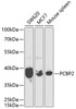 Immunology Antibodies 2 Anti-PCBP2 Antibody CAB2531