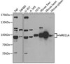 Epigenetics and Nuclear Signaling Antibodies 3 Anti-MRE11A Antibody CAB2559