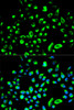 Cell Biology Antibodies 8 Anti-YWHAQ Antibody CAB2563