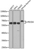 KO Validated Antibodies 1 Anti-PDCD4 Antibody CAB2570KO Validated