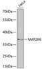 Cell Death Antibodies 1 Anti-MAP2K6 Antibody CAB2575