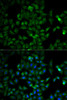 Metabolism Antibodies 2 Anti-TPI1 Antibody CAB2579