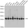 Metabolism Antibodies 2 Anti-TPI1 Antibody CAB2579