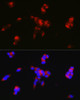 Cell Biology Antibodies 8 Anti-PPP1R1B Antibody CAB2580