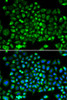 Cell Biology Antibodies 8 Anti-DRP1 Antibody CAB2586