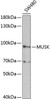 Developmental Biology Anti-MUSK Antibody CAB2591