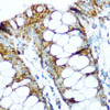 Cell Biology Antibodies 8 Anti-NDUFS1 Antibody CAB2592