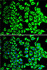 Cell Biology Antibodies 8 Anti-SDHA Antibody CAB2594