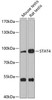 Epigenetics and Nuclear Signaling Antibodies 3 Anti-STAT4 Antibody CAB2638