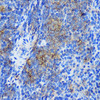 Epigenetics and Nuclear Signaling Antibodies 3 Anti-STAT4 Antibody CAB2638