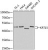 Cell Biology Antibodies 8 Anti-KRT15 Antibody CAB2660