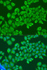 Epigenetics and Nuclear Signaling Antibodies 3 Anti-IGF2BP2 Antibody CAB2749