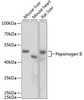 Cell Biology Antibodies 8 Anti-Pepsinogen II Antibody CAB2788