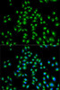 Cell Biology Antibodies 8 Anti-USO1 Antibody CAB2796