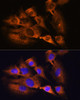 Neuroscience Anti-ACHE Antibody CAB2806