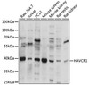 Immunology Antibodies 2 Anti-HAVCR1 Antibody CAB2831
