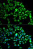 Immunology Antibodies 2 Anti-CUL2 Antibody CAB2881