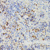 Metabolism Antibodies 2 Anti-DUT Antibody CAB2901