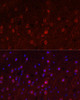 Signal Transduction Antibodies 2 Anti-SLC1A1 Antibody CAB2903