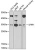 Developmental Biology Anti-SFRP1 Antibody CAB2911