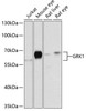 Signal Transduction Antibodies 2 Anti-GRK1 Antibody CAB2966