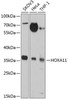 Epigenetics and Nuclear Signaling Antibodies 3 Anti-HOXA11 Antibody CAB2976