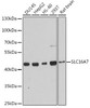 Signal Transduction Antibodies 2 Anti-SLC16A7 Antibody CAB3015