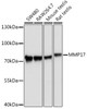 Cell Biology Antibodies 8 Anti-MMP17 Antibody CAB3030