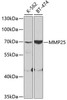 Cell Biology Antibodies 8 Anti-MMP25 Antibody CAB3032