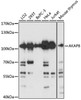 Immunology Antibodies 2 Anti-AKAP8 Antibody CAB3049