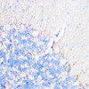 Signal Transduction Antibodies 2 Anti-GRIN2B Antibody CAB3056